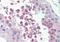 Lysine Methyltransferase 2B antibody, orb88981, Biorbyt, Immunohistochemistry paraffin image 