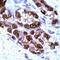 Androgen Receptor antibody, PA1-37079, Invitrogen Antibodies, Immunohistochemistry paraffin image 