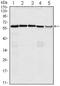 Cell Division Cycle 25C antibody, NBP1-47475, Novus Biologicals, Western Blot image 