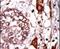 Receptor For Activated C Kinase 1 antibody, PA5-15324, Invitrogen Antibodies, Immunohistochemistry paraffin image 