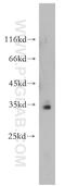 Phosphopantothenoylcysteine Synthetase antibody, 18001-1-AP, Proteintech Group, Western Blot image 