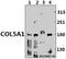 Collagen Type V Alpha 1 Chain antibody, GTX66675, GeneTex, Western Blot image 