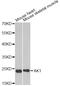 Adenylate Kinase 1 antibody, LS-C748509, Lifespan Biosciences, Western Blot image 