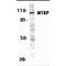 MDM2 Binding Protein antibody, MBS151250, MyBioSource, Western Blot image 