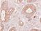 Fibrinogen Gamma Chain antibody, NBP1-31766, Novus Biologicals, Immunohistochemistry paraffin image 