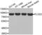 Procollagen-Lysine,2-Oxoglutarate 5-Dioxygenase 2 antibody, abx001849, Abbexa, Western Blot image 