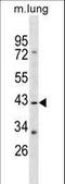 Ras Association Domain Family Member 1 antibody, LS-C158808, Lifespan Biosciences, Western Blot image 