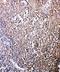 C-X-C Motif Chemokine Receptor 6 antibody, LS-C313200, Lifespan Biosciences, Immunohistochemistry paraffin image 