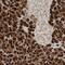 Chromosome 21 Open Reading Frame 58 antibody, PA5-57157, Invitrogen Antibodies, Immunohistochemistry frozen image 