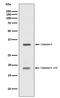 Caspase 6 antibody, M02631-1, Boster Biological Technology, Western Blot image 