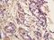 PMS1 Homolog 2, Mismatch Repair System Component antibody, orb185880, Biorbyt, Immunohistochemistry paraffin image 