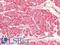 Bone Morphogenetic Protein 4 antibody, LS-A12468, Lifespan Biosciences, Immunohistochemistry paraffin image 