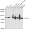 Dynein Cytoplasmic 1 Intermediate Chain 1 antibody, 19-179, ProSci, Western Blot image 