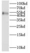Smad Nuclear Interacting Protein 1 antibody, FNab08065, FineTest, Western Blot image 