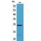 Interleukin 24 antibody, LS-C387171, Lifespan Biosciences, Western Blot image 