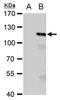 Mismatch repair endonuclease PMS2 antibody, PA5-29835, Invitrogen Antibodies, Western Blot image 