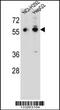 Tripartite Motif Containing 64 antibody, 56-974, ProSci, Western Blot image 