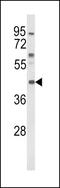 Melanocortin 3 Receptor antibody, GTX81071, GeneTex, Western Blot image 