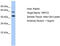 Transmembrane And Tetratricopeptide Repeat Containing 2 antibody, TA330979, Origene, Western Blot image 