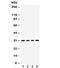 TNF Superfamily Member 13b antibody, R32360, NSJ Bioreagents, Western Blot image 