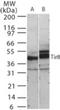 Single Ig IL-1-related receptor antibody, NB100-56890, Novus Biologicals, Western Blot image 