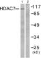 Histone Deacetylase 7 antibody, abx013107, Abbexa, Western Blot image 