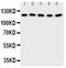Desmoglein 2 antibody, PA5-79171, Invitrogen Antibodies, Western Blot image 