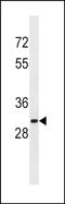 Sulfotransferase Family 1A Member 2 antibody, PA5-48748, Invitrogen Antibodies, Western Blot image 