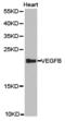 Vascular Endothelial Growth Factor B antibody, LS-C192930, Lifespan Biosciences, Western Blot image 