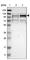 Transmembrane And Tetratricopeptide Repeat Containing 1 antibody, HPA016720, Atlas Antibodies, Western Blot image 