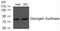 Glycogen Synthase 1 antibody, GTX50798, GeneTex, Western Blot image 