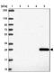Glutathione S-Transferase Alpha 1 antibody, NBP2-46817, Novus Biologicals, Western Blot image 
