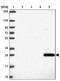 Glutathione S-transferase A1 antibody, NBP2-46817, Novus Biologicals, Western Blot image 