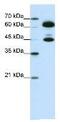 Small Nuclear Ribonucleoprotein U1 Subunit 70 antibody, ab51266, Abcam, Western Blot image 