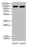 Integrin Subunit Alpha L antibody, CSB-PA011875LA01HU, Cusabio, Western Blot image 