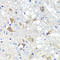Phosphoserine Phosphatase antibody, 23-282, ProSci, Immunohistochemistry paraffin image 
