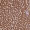 Alcohol Dehydrogenase 1A (Class I), Alpha Polypeptide antibody, NBP2-46756, Novus Biologicals, Immunohistochemistry frozen image 