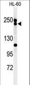 BLM RecQ Like Helicase antibody, LS-C156824, Lifespan Biosciences, Western Blot image 