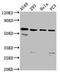 DEAD-Box Helicase 28 antibody, LS-C672668, Lifespan Biosciences, Western Blot image 