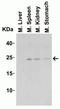 Interleukin 23 Subunit Alpha antibody, NBP1-76697, Novus Biologicals, Western Blot image 