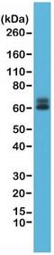 Paxillin antibody, NBP2-61576, Novus Biologicals, Western Blot image 