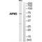 Collagen Type XI Alpha 1 Chain antibody, A02909, Boster Biological Technology, Western Blot image 