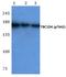 TBC1 Domain Family Member 4 antibody, A02004T642, Boster Biological Technology, Western Blot image 