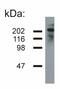 Neurofilament Heavy antibody, LS-B4502, Lifespan Biosciences, Western Blot image 
