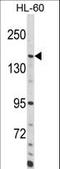 Adenylate Cyclase 8 antibody, LS-C156072, Lifespan Biosciences, Western Blot image 