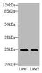 TIMP Metallopeptidase Inhibitor 3 antibody, LS-C285720, Lifespan Biosciences, Western Blot image 