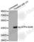 ATF4 antibody, AP0309, ABclonal Technology, Western Blot image 