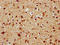 Fibroblast Growth Factor 1 antibody, LS-C375723, Lifespan Biosciences, Immunohistochemistry paraffin image 