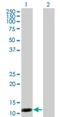 S100 Calcium Binding Protein A7 antibody, H00006278-M01, Novus Biologicals, Western Blot image 