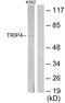 Thyroid Hormone Receptor Interactor 4 antibody, LS-C119068, Lifespan Biosciences, Western Blot image 